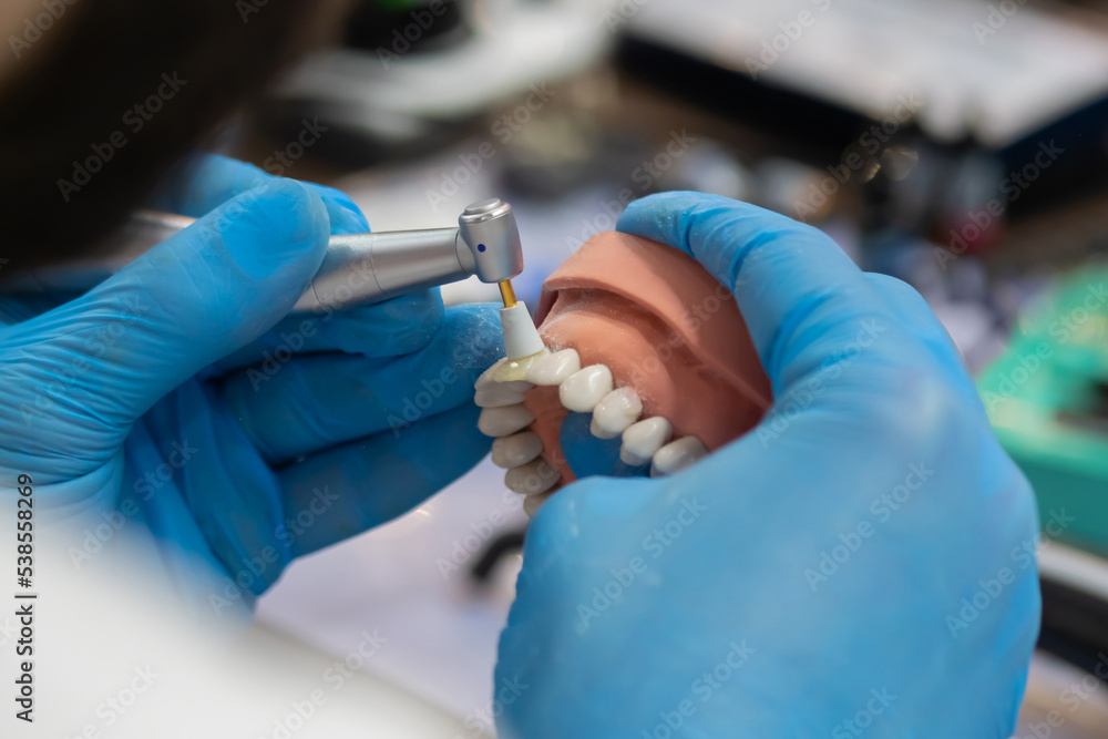 CAD/CAM technológia a fogorvosi műhelyekben: az innováció nyomában